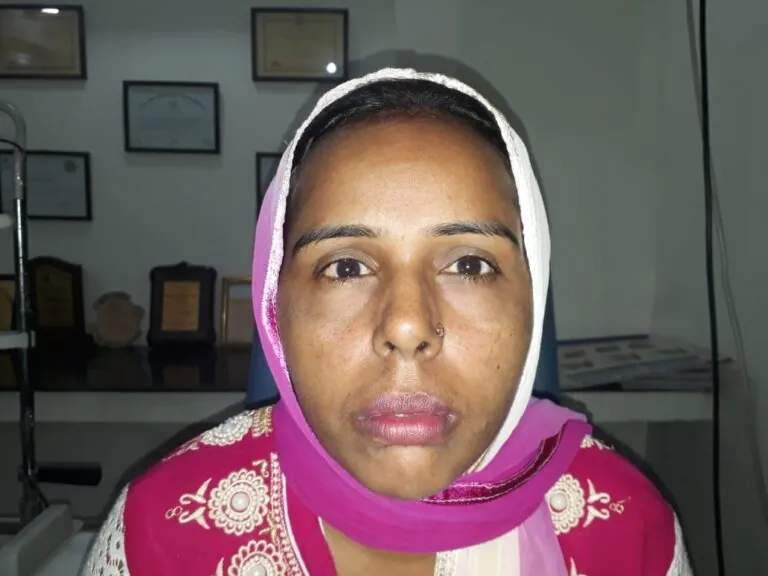 Patient 04 after treatment