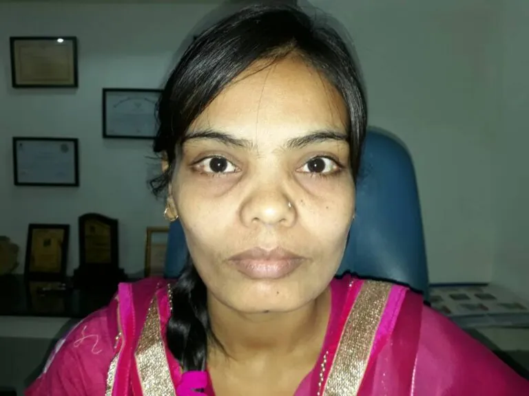 Patient 06 after treatment