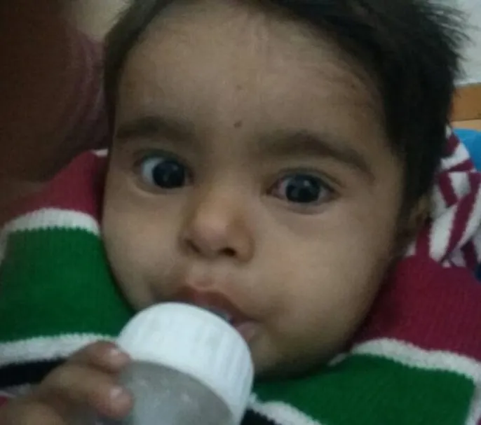 Patient 02 after treatment