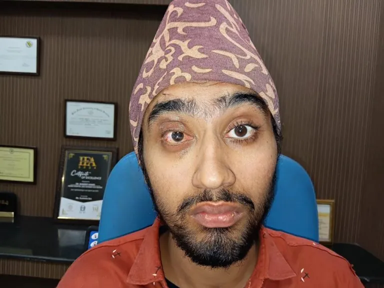 Patient 03 before treatment
