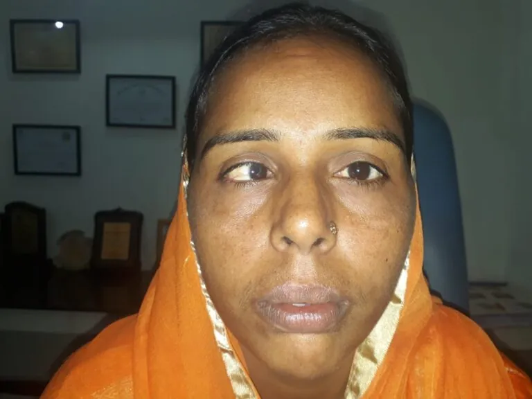 Patient 04 before treatment