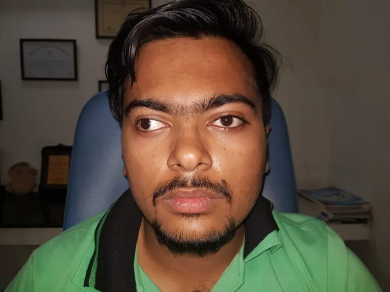 Patient 05 before treatment