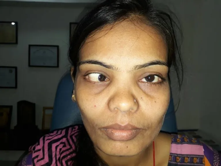 Patient 06 before treatment
