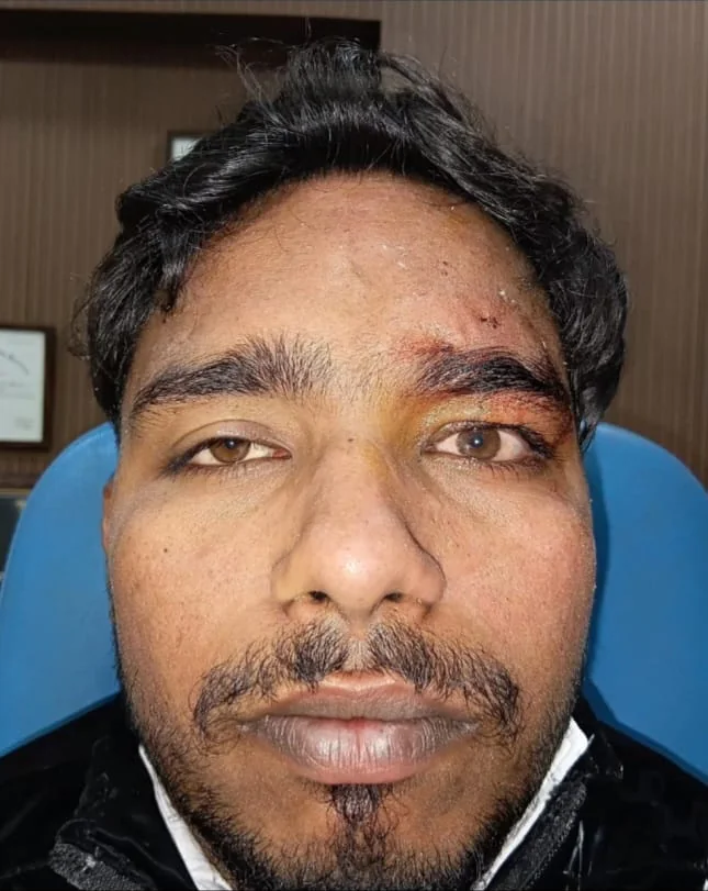 Patient 01 before treatment